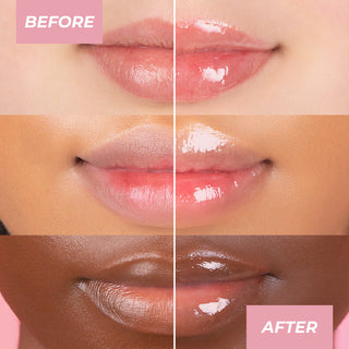l carnitine for oily skin Carnitine