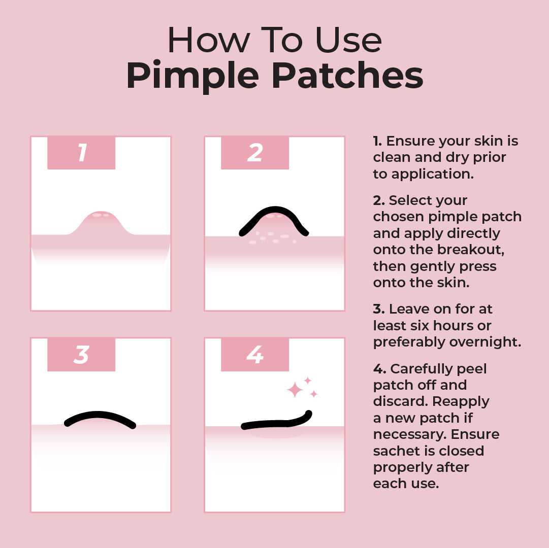 Miracle Pimple Patch – MCoBeauty US